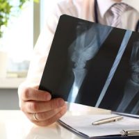 SurgeryConsult