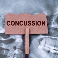 WorkConcussion WorkConcussion